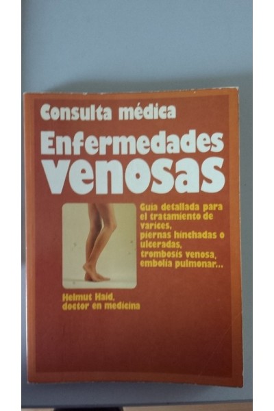 ENFERMEDADES VENOSAS. Consulta medica